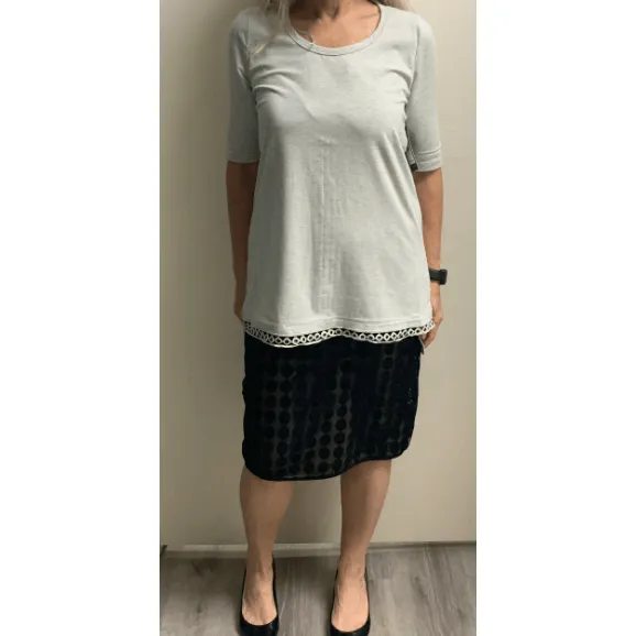 Short sleeve top